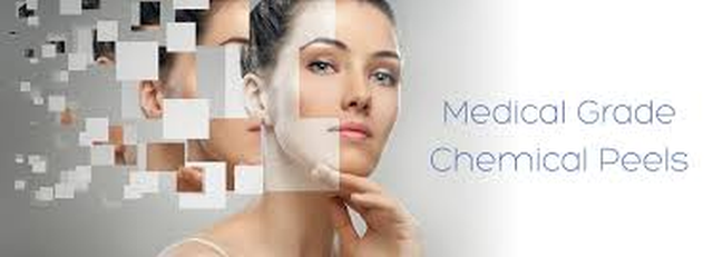 Benefits of chemical peels